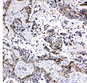 Anti-MRP1 Rabbit Polyclonal Antibody