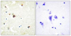 Immunohistochemical analysis of paraffin-embedded human brain tissue using Anti-TRIM3 Antibody. The right hand panel represents a negative control, where the antibody was pre-incubated with the immunising peptide