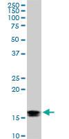 Anti-ACP1 Mouse Monoclonal Antibody [clone: 2A3]