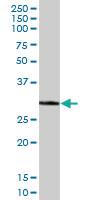 Anti-ECH1 Mouse Polyclonal Antibody