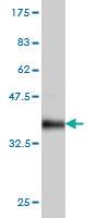 Anti-OXSR1 Mouse Monoclonal Antibody [clone: 1F6]