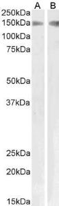 Approx 150kDa band observed in Human Kidney and Pig Lung lysates (calculated MW of 153kDa according to NP_001007268.1). Recommended concentration: 1-3 µg/ml