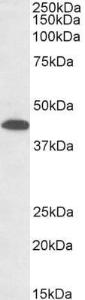 Anti-GNA12 Antibody (A83074) (0.3 µg/ml) staining of Mouse Heart lysate (35 µg protein in RIPA buffer). Primary incubation was 1 hour. Detected by chemiluminescence