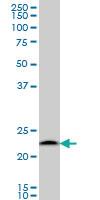 Anti-PSMB6 Mouse Monoclonal Antibody [clone: S51]