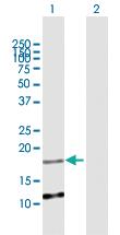 Anti-ATRAID Mouse Polyclonal Antibody