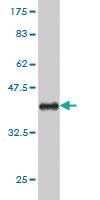 Anti-OXSR1 Mouse Monoclonal Antibody [clone: 4D12]