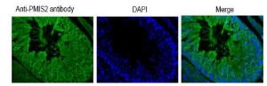 Anti-PMIS2 Antibody