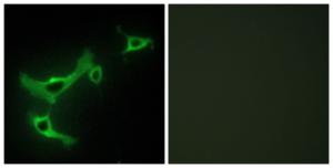 Immunofluorescence analysis of NIH/3T3 cells using Anti-TRIM3 Antibody. The right hand panel represents a negative control, where the antibody was pre-incubated with the immunising peptide