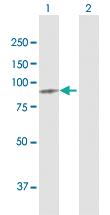 Anti-MTDH Rabbit Polyclonal Antibody