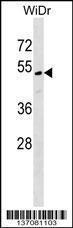 Anti-CENPU Rabbit Polyclonal Antibody (FITC (Fluorescein Isothiocyanate))