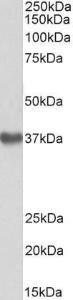 Anti-GNA12 Antibody (A83074) (1 µg/ml) staining of Human Placenta lysate (35 µg protein in RIPA buffer). Primary incubation was 1 hour. Detected by chemiluminescence