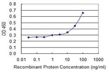 Anti-ACP1 Mouse Monoclonal Antibody [clone: 2A3]