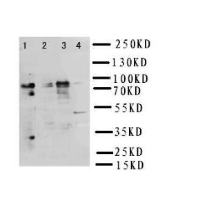 Anti-NRG2 Rabbit Polyclonal Antibody