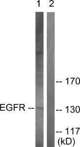 Western blot analysis of lysates from A431 cells using Anti-EGFR Antibody. The right hand lane represents a negative control, where the antibody is blocked by the immunising peptide.