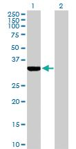 Anti-ECH1 Rabbit Polyclonal Antibody