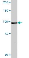 Anti-KDM1A Mouse Polyclonal Antibody