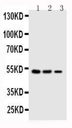 Anti-Kallistatin Rabbit Polyclonal Antibody