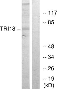 Western blot analysis of lysates from 293 cells using Anti-TRI18 Antibody. The right hand lane represents a negative control, where the antibody is blocked by the immunising peptide