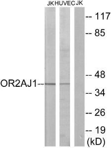 Anti-OR2AJ1 antibody