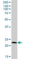 Anti-ATRAID Mouse Polyclonal Antibody