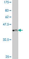 Anti-AEBP1 Mouse Polyclonal Antibody