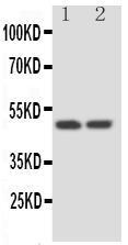 Anti-Kallistatin Rabbit Polyclonal Antibody