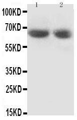 Anti-GAD65 Rabbit Polyclonal Antibody