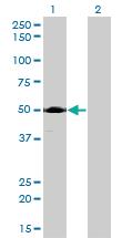 Anti-ACP2 Mouse Monoclonal Antibody [clone: M1-4A12]