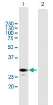 Anti-ECHS1 Mouse Polyclonal Antibody