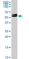 Anti-CELF2 Rabbit Polyclonal Antibody