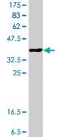 Anti-ST3GAL4 Mouse Polyclonal Antibody