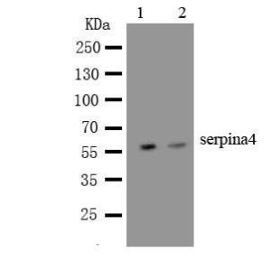 Anti-Kallistatin Rabbit Polyclonal Antibody