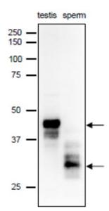 Anti-SPACA1 Antibody