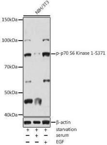 Western blot analysis of extracts of NIH/3T3, using Anti-S6K1 (phospho Ser371) Antibody (A309030) at 1:1,000 dilutio