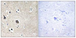 Immunohistochemical analysis of paraffin-embedded human brain tissue using Anti-TRI18 Antibody. The right hand panel represents a negative control, where the antibody was pre-incubated with the immunising peptide