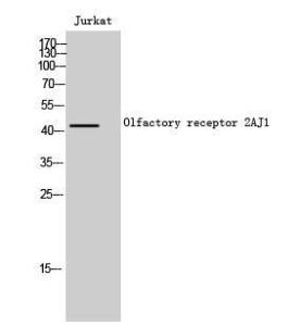 Anti-OR2AJ1 antibody