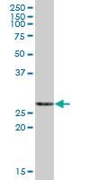 Anti-ECHS1 Mouse Polyclonal Antibody