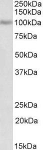 Anti-POSTN Antibody (A83077) (2 µg/ml) staining of MCF7 lysate (35 µg protein in RIPA buffer). Primary incubation was 1 hour. Detected by chemiluminescence