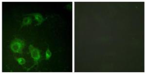 Immunofluorescence analysis of HUVEC cells using Anti-EGFR Antibody. The right hand panel represents a negative control, where the antibody was pre-incubated with the immunising peptide.