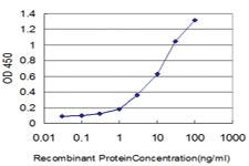 Anti-HOXA11 Mouse Monoclonal Antibody [clone: 8E10]