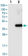 Anti-BCKDHB Rabbit Polyclonal Antibody