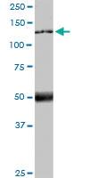 Anti-MTUS1 Mouse Monoclonal Antibody [clone: 1C7]