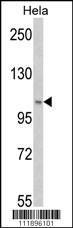 Anti-PI3KC3 Rabbit Polyclonal Antibody (AP (Alkaline Phosphatase))