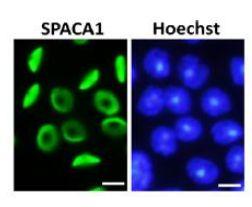 Anti-SPACA1 Antibody