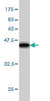 Anti-AEBP1 Mouse Monoclonal Antibody [clone: 1D2]