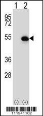 Anti-FUCA2 Rabbit Polyclonal Antibody (AP (Alkaline Phosphatase))