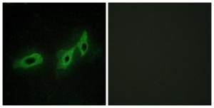 Immunofluorescence analysis of HeLa cells using Anti-TRI18 Antibody. The right hand panel represents a negative control, where the antibody was pre-incubated with the immunising peptide