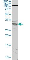 Anti-HOXA11 Mouse Monoclonal Antibody [clone: 8B8]