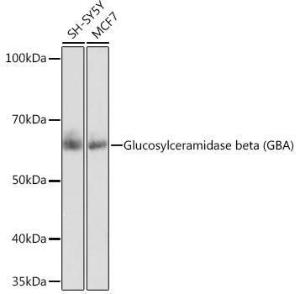 Western blot analysis of extracts of various cell lines, using Anti-GBA Antibody [ARC0500] (A309031) at 1:1,000 dilution