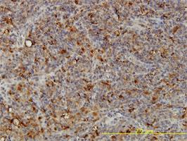 Anti-ACP2 Mouse Monoclonal Antibody [clone: M1-4A12]